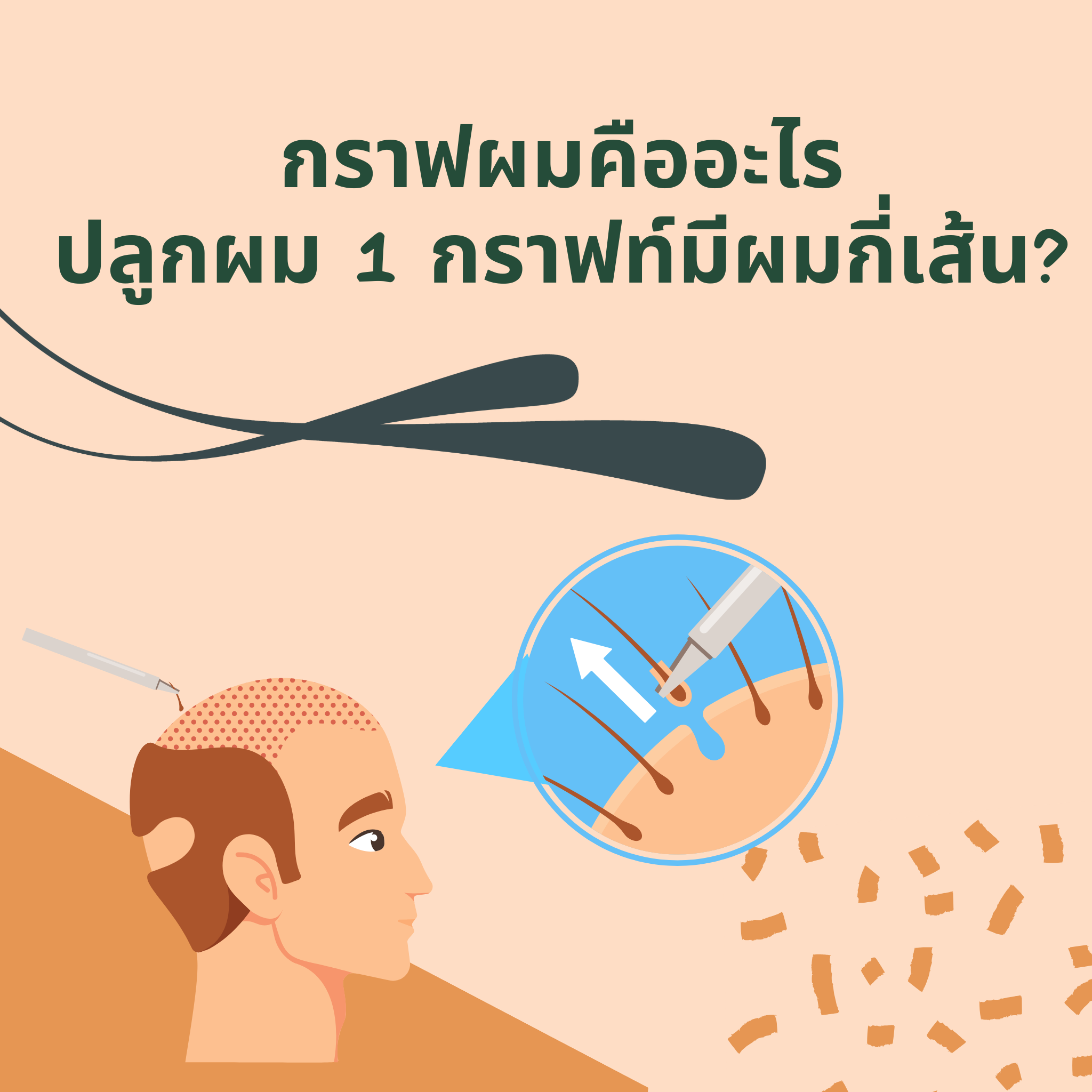 กราฟผมคืออะไร ปลูกผม 1 กราฟท์มีผมกี่เส้น?