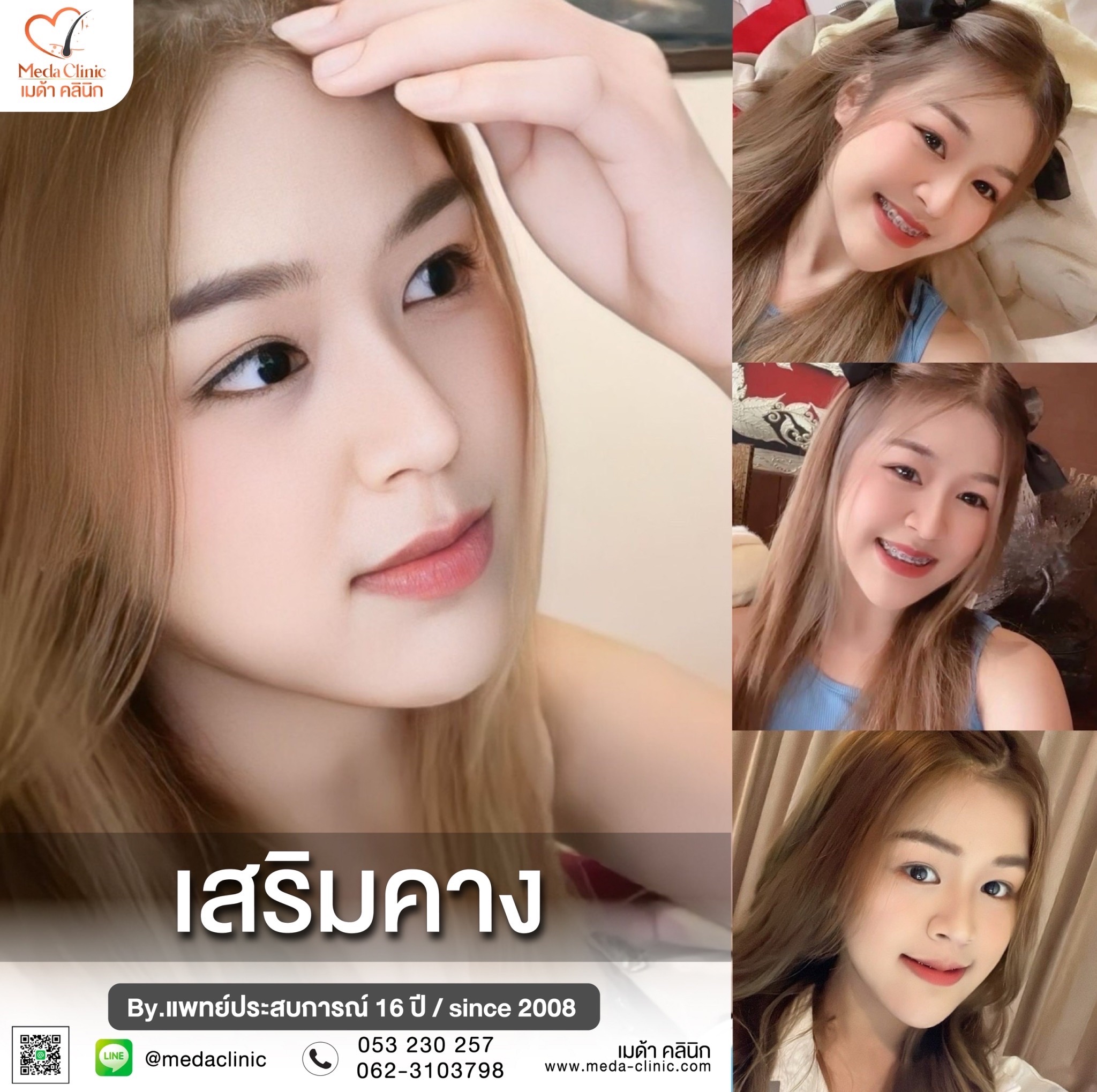 เสริมคางที่ไหนดี