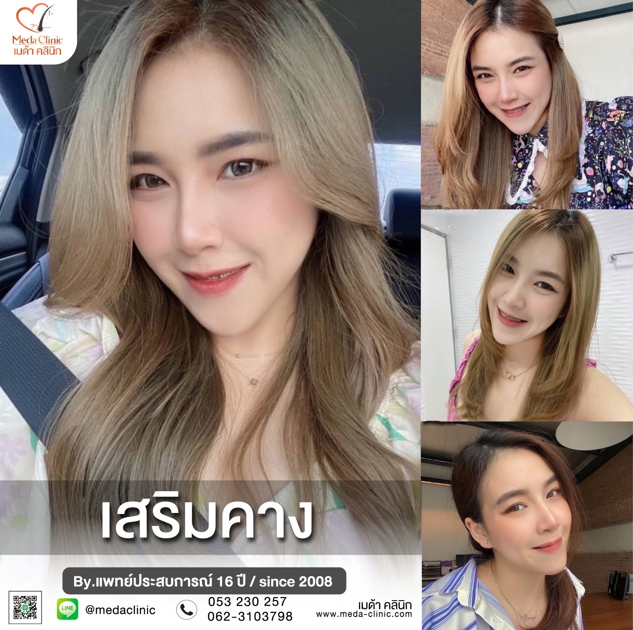 เสริมคางที่ไหนดี