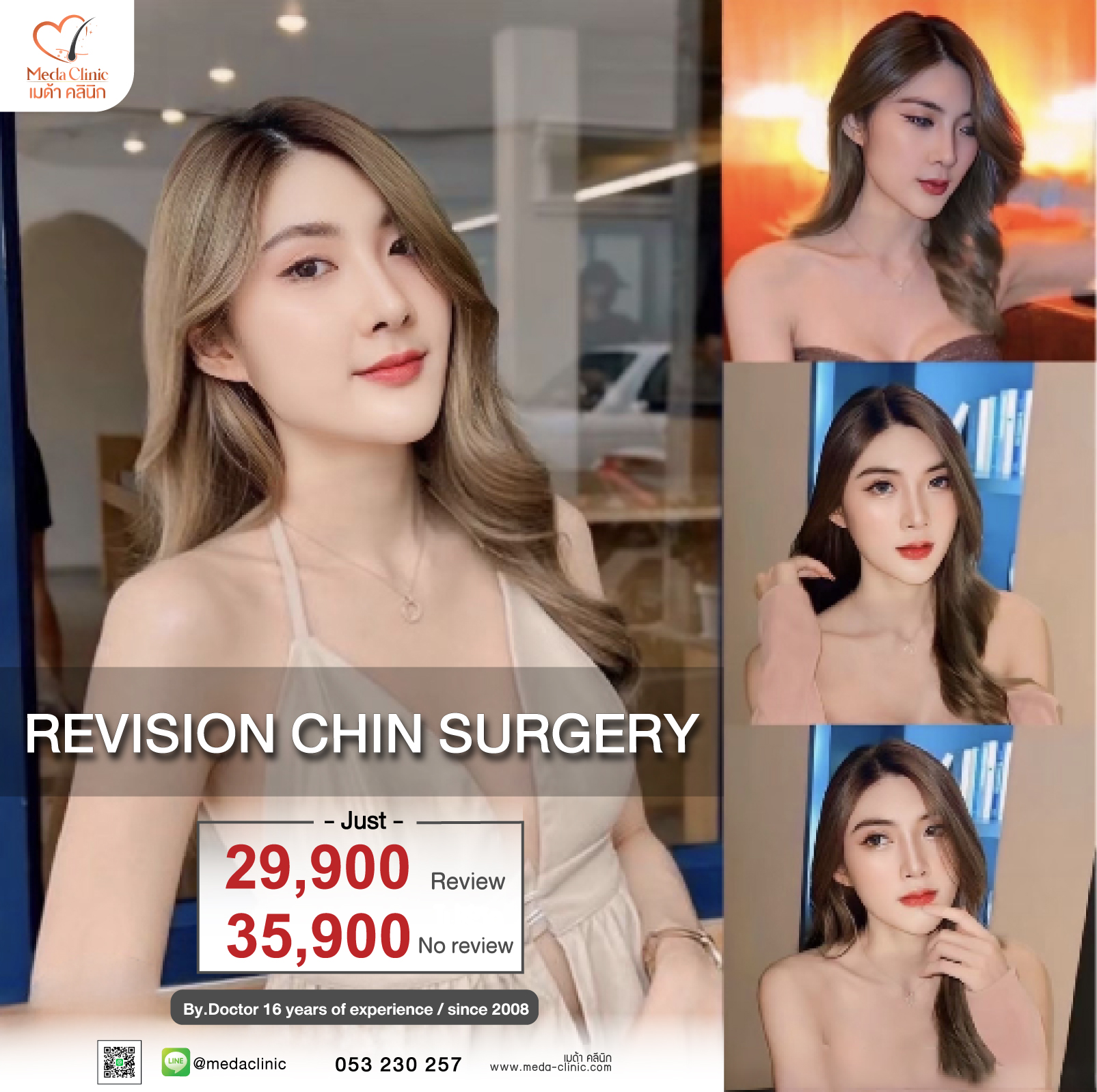 Revision Chin surgery