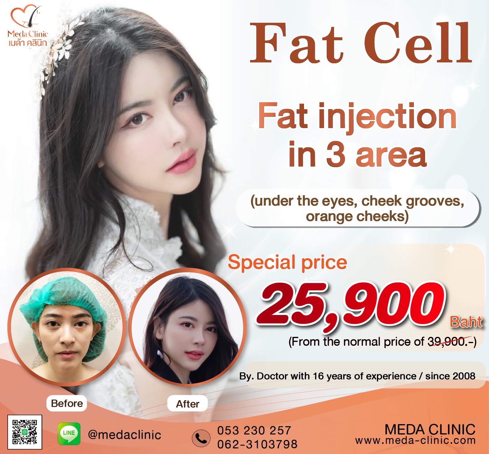 What is facial fat grafting (FAT CELL)?